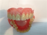 Dental Prosthetic Solutions